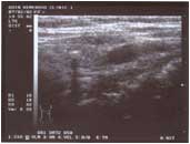  Ultrasonic scanning Feb 7, 2002