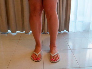 Негнущееся колено. 5 процедур.